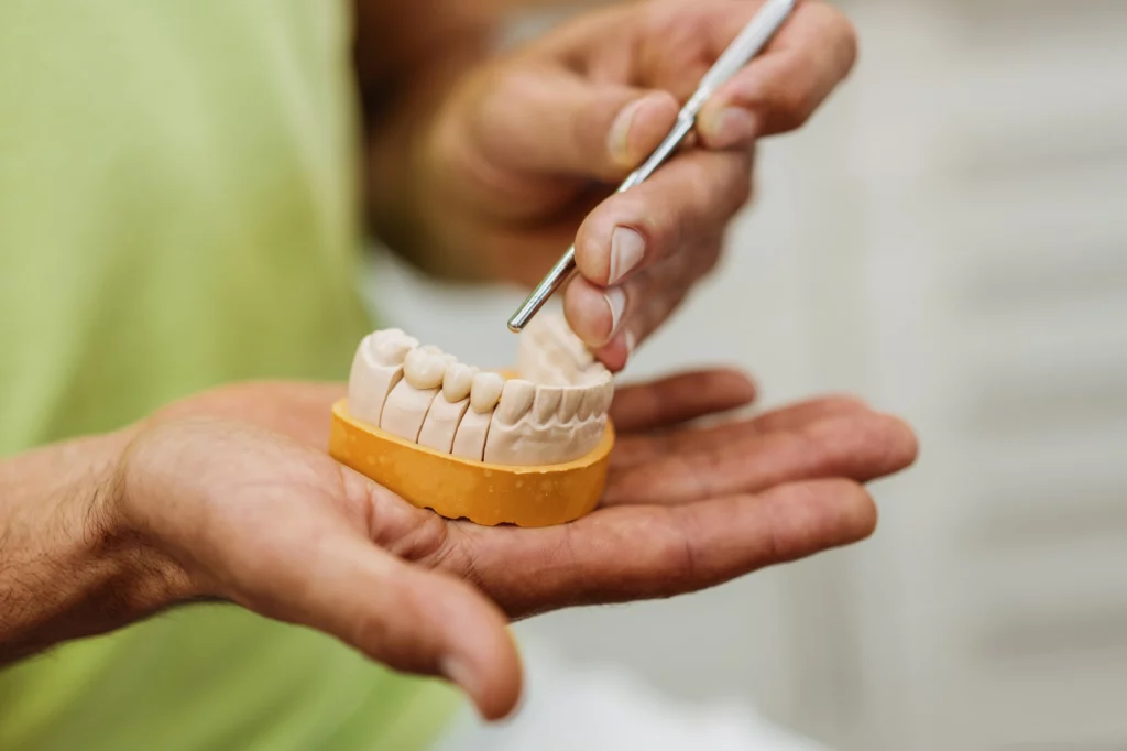 Detailbild mit Kiefermodell. Zahnarztpraxis Mathias Jahn, Heidenau